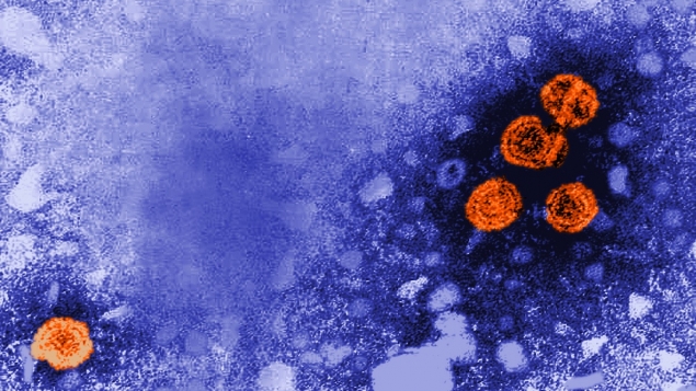 Des particules du virus de l'hépatite B (orange) sont visibles sur cette image en microscopie électronique à transmission. Les virions ronds ont un diamètre de 42 nanomètres. /CDC/ Dr. Erskine Palmer